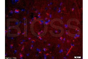 Formalin-fixed and paraffin-embedded human brain labeled with Rabbit Anti-NGAL Polyclonal Antibody, Unconjugated (ABIN685627) 1:200 followed by conjugation to the PE secondary antibody and DAPI staining (Lipocalin 2 antibody  (AA 101-198))