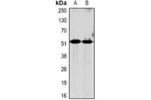 Western blot analysis of GRPR expression in mouse brain (A), rat brain (B) whole cell lysates.