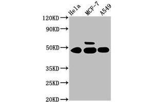 Western Blot Positive WB detected in: Hela whole cell lysate, MCF-7 whole cell lysate, A549 whole cell lysate All lanes: CSNK1G1 antibody at 3. (CSNK1G1 antibody  (Isoform gamma 1))