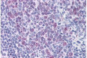 Human Tonsil: Formalin-Fixed, Paraffin-Embedded (FFPE) (HDAC4 antibody  (AA 551-648))