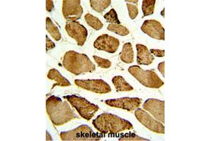 Formalin-fixed and paraffin-embedded human skeletal muscle with CDKN1B (phospho S10) polyclonal antibody , which was peroxidase-conjugated to the secondary antibody, followed by DAB staining.
