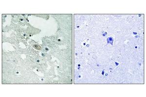 Immunohistochemistry analysis of paraffin-embedded human brain tissue using BLNK (Phospho-Tyr84) antibody. (B-Cell Linker antibody  (pTyr84))