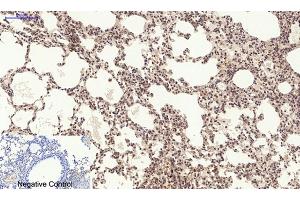 Immunohistochemical analysis of paraffin-embedded mouse lung tissue. (PERK antibody  (pThr981))