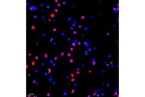 Immunofluorescence of paraffin embedded rat brain using MED17 (ABIN7074579) at dilution of 1:1500 (200x lens)