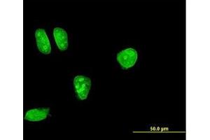 Image no. 2 for anti-Mitogen-Activated Protein Kinase Kinase 7 (MAP2K7) (AA 1-100) antibody (ABIN598899) (MAP2K7 antibody  (AA 1-100))