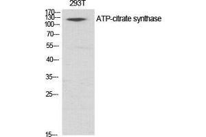 Western Blot (WB) analysis of specific cells using ATP-citrate synthase Polyclonal Antibody. (ACLY antibody  (Ser1227))