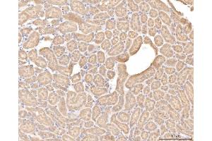 IHC analysis of BHMT using anti-BHMT antibody (ABIN7599940). (BHMT antibody  (AA 13-386))