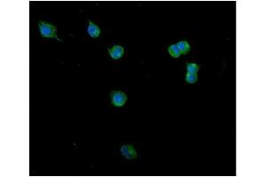 IF analysis of Clathrin heavy chain/CLTC using anti-Clathrin heavy chain/CLTC antibody (ABIN7602704). (Clathrin Heavy Chain (CLTC) (AA 967-1668) antibody)