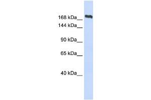 WB Suggested Anti-SMC2 Antibody Titration:  0.