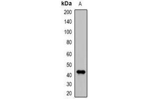 Western blot analysis of DDB2 expression in MCF7 (A) whole cell lysates. (DDB2 antibody)