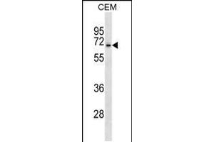 Western blot analysis in CEM cell line lysates (35ug/lane). (ASIC3 antibody  (N-Term))