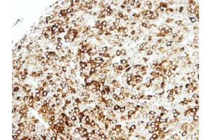 IHC-P Image Immunohistochemical analysis of paraffin-embedded BT483 xenograft, using STAP2, antibody at 1:100 dilution. (STAP2 antibody  (C-Term))