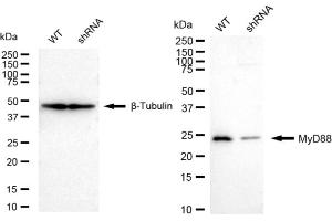 Western blotting analysis using MyD88 antibody (ABIN7799510). (Recombinant MYD88 antibody)