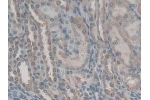 DAB staining on IHC-P; Samples: Rat Kidney Tissue (Retinol Binding Protein 5 antibody  (AA 19-201))