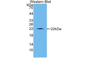 Western blot analysis of the recombinant protein. (CD6 antibody  (AA 477-644))