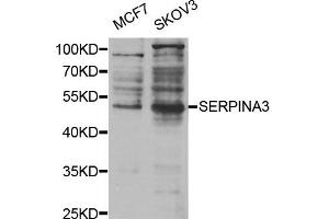 Western Blotting (WB) image for anti-serpin Peptidase Inhibitor, Clade A (Alpha-1 Antiproteinase, Antitrypsin), Member 3 (SERPINA3) antibody (ABIN1875398) (SERPINA3 antibody)