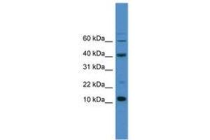 Image no. 1 for anti-Caspase 3 (CASP3) (AA 80-129) antibody (ABIN6745427) (Caspase 3 antibody  (AA 80-129))
