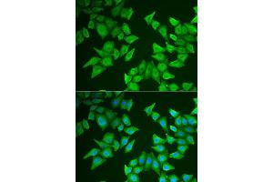 Immunofluorescence analysis of HeLa cell using ALAS2 antibody. (ALAS2 antibody)
