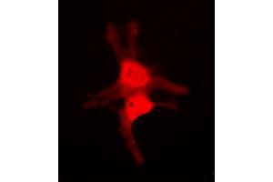 Immunofluorescent analysis of JNK3 staining in NIH3T3 cells. (MAPK10 antibody  (C-Term))