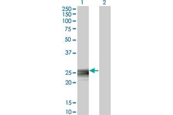 RAB3B antibody  (AA 120-219)