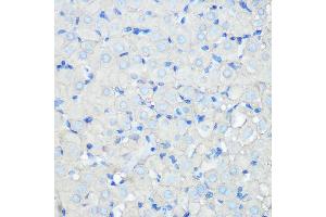 Immunohistochemistry of paraffin-embedded rat ovary using SR-BI Rabbit mAb (ABIN7270156) at dilution of 1:100 (40x lens). (SCARB1 antibody)