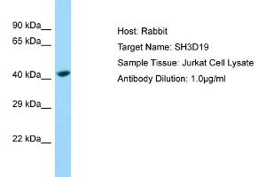 Host: Rabbit Target Name: SH3D19 Sample Type: Jurkat Whole Cell lysates Antibody Dilution: 1. (SH3D19 antibody  (C-Term))