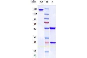 Anti-TFPI Reference Antibody (concizumab) on SDS-PAGE under reducing (R) condition. (Recombinant TFPI (Concizumab Biosimilar) antibody)