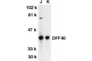 Image no. 1 for anti-DNA Fragmentation Factor, 40kDa, beta Polypeptide (Caspase-Activated DNase) (DFFB) (AA 3-18) antibody (ABIN203319) (DFFB antibody  (AA 3-18))