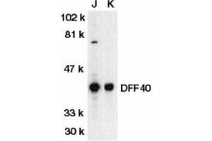 Image no. 1 for anti-DNA Fragmentation Factor, 40kDa, beta Polypeptide (Caspase-Activated DNase) (DFFB) (AA 3-18) antibody (ABIN203319)