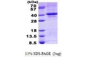 Figure annotation denotes ug of protein loaded and % gel used. (TDP1 Protein)