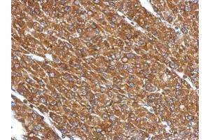 IHC-P Image Immunohistochemical analysis of paraffin-embedded U87 xenograft, using CYP27A1, antibody at 1:500 dilution. (CYP27A1 antibody  (Center))