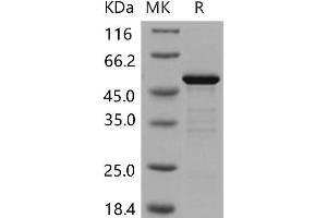 Western Blotting (WB) image for 14-3-3 epsilon (YWHAE) protein (GST tag) (ABIN7320190)