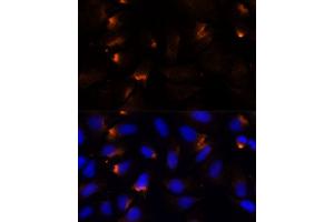 Immunofluorescence analysis of U-2 OS cells using MMP3 Polyclonal Antibody (ABIN3021708, ABIN3021709, ABIN3021710 and ABIN6215578) at dilution of 1:100 (40x lens).