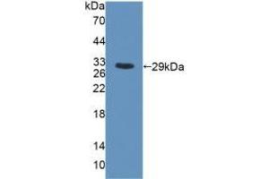 Western blot analysis of recombinant Rat MYH6. (MYH6 antibody  (AA 419-666))