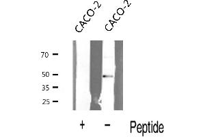 Western blot analysis of N Myc expression in CACO-2 cells (MYCN antibody  (Internal Region))