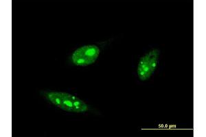 Immunofluorescence of monoclonal antibody to IRF4 on HeLa cell. (IRF4 antibody  (AA 342-451))