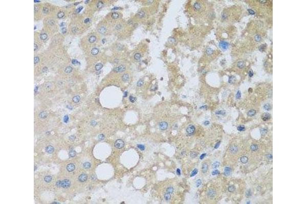 CHMP1B antibody