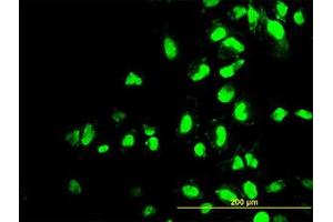 Image no. 3 for anti-Polymerase (RNA) I Polypeptide C, 30kDa (POLR1C) (AA 1-347) antibody (ABIN599083) (POLR1C antibody  (AA 1-347))