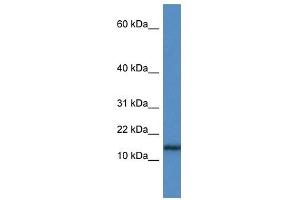 Western Blot showing HIST1H3A antibody used at a concentration of 1 ug/ml against Jurkat Cell Lysate (HIST1H3A antibody  (N-Term))