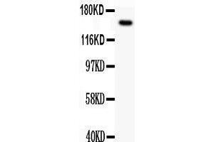 Observed bind size: 154KD (c-MET antibody  (AA 208-407))
