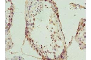 Immunohistochemistry of paraffin-embedded human testis tissue using ABIN7174944 at dilution of 1:100 (Myosin IC antibody  (AA 804-1063))