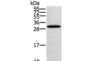 Western Blot analysis of Human fetal brain tissue using STARD5 Polyclonal Antibody at dilution of 1:400 (STARD5 antibody)