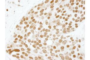 Immunohistochemistry (IHC) image for anti-Activated RNA Polymerase II Transcriptional Coactivator p15 (SUB1) (AA 77-127) antibody (ABIN7448719) (SUB1 antibody  (AA 77-127))