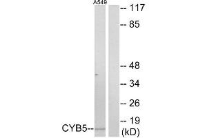 Western Blotting (WB) image for anti-Cytochrome b5 (CYTB5) (Internal Region) antibody (ABIN1850420) (Cytochrome b5 (CYTB5) (Internal Region) antibody)