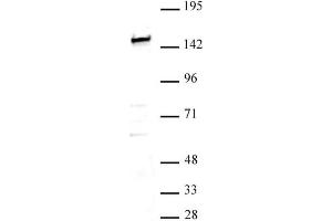 SMARCC1 / BAF155 antibody (pAb) tested by Western blot.