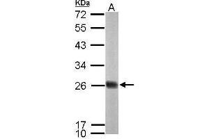 WB Image Sample (50 ug of whole cell lysate) A: mouse brain 12% SDS PAGE antibody diluted at 1:1000 (NDUFS8 antibody  (Center))