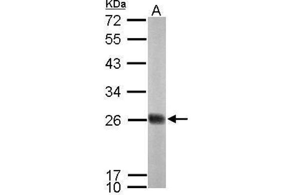 NDUFS8 antibody  (Center)