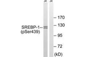Western blot analysis of extracts from Jurkat cells treated with TNF 20ng/ml 30', using SREBP-1 (Phospho-Ser439) Antibody.