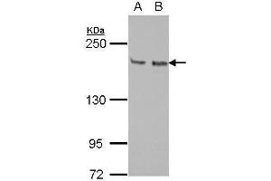WB Image Sample (30 ug of whole cell lysate) A: Jurkat B: Raji 5% SDS PAGE antibody diluted at 1:1000 (KIF14 antibody  (N-Term))