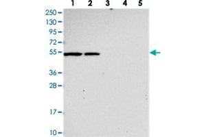 Western blot analysis of Lane 1: RT-4, Lane 2: U-251 MG, Lane 3: Human Plasma, Lane 4: Liver, Lane 5: Tonsil with SLC24A6 polyclonal antibody . (SLC24A6 antibody)